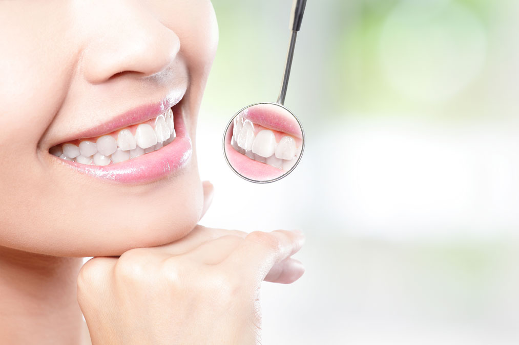 Dental Implant